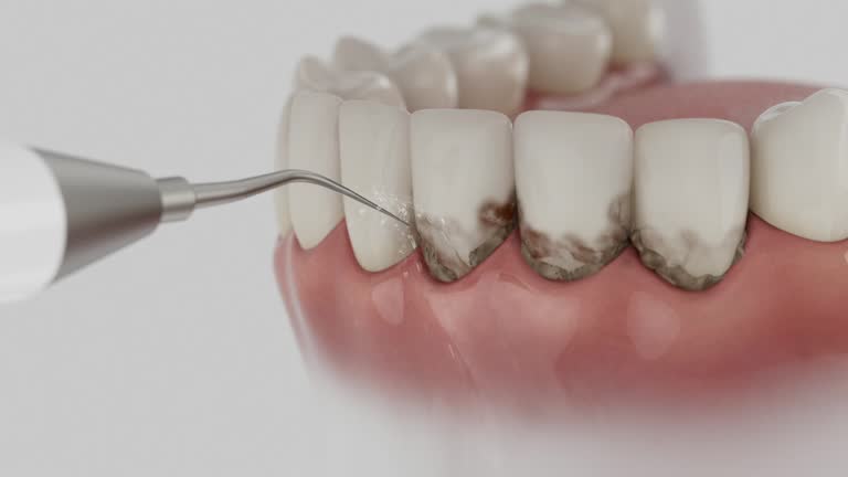 Trusted Tooth Extraction service in Lakewood Park, FL - Dentist Open Now